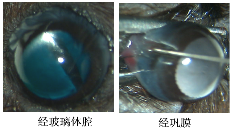 AAV基因治疗在眼科疾病研究中的应用及常见注射方式