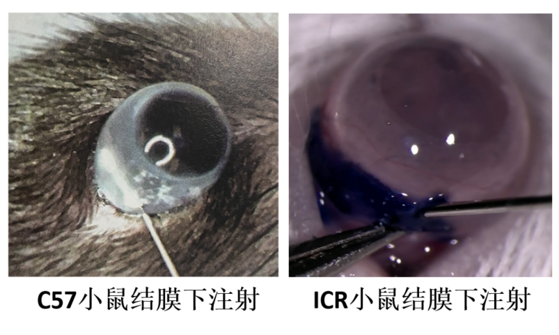 AAV基因治疗在眼科疾病研究中的应用及常见注射方式