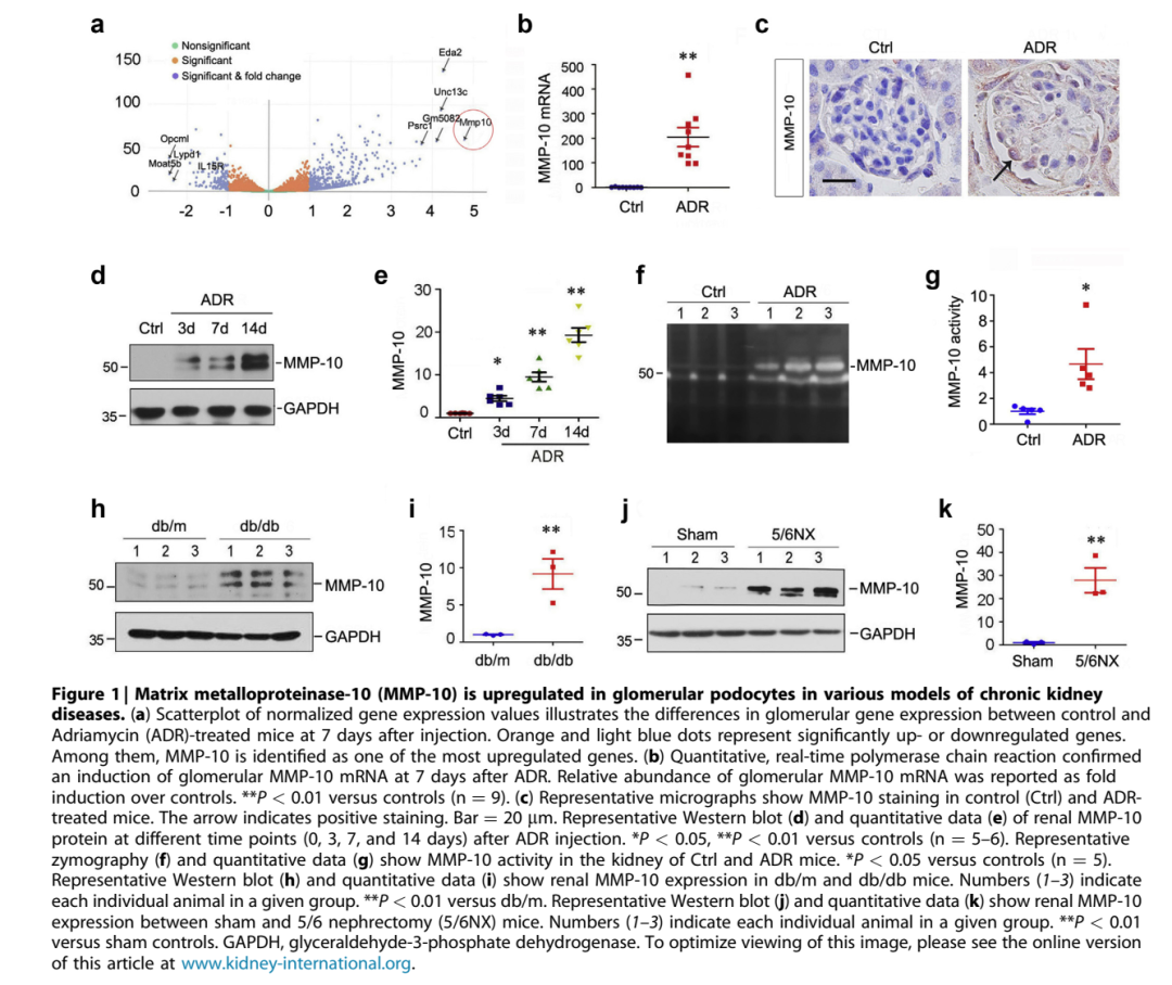MMP10-新的足细胞损伤介导分子
