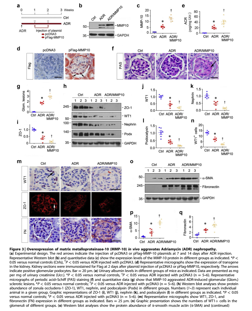 MMP10加重ADR模型足细胞损伤  及肾小球硬化