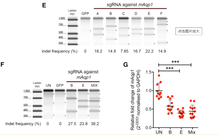 青光眼——造成不可逆伤害的隐形视力“杀手”