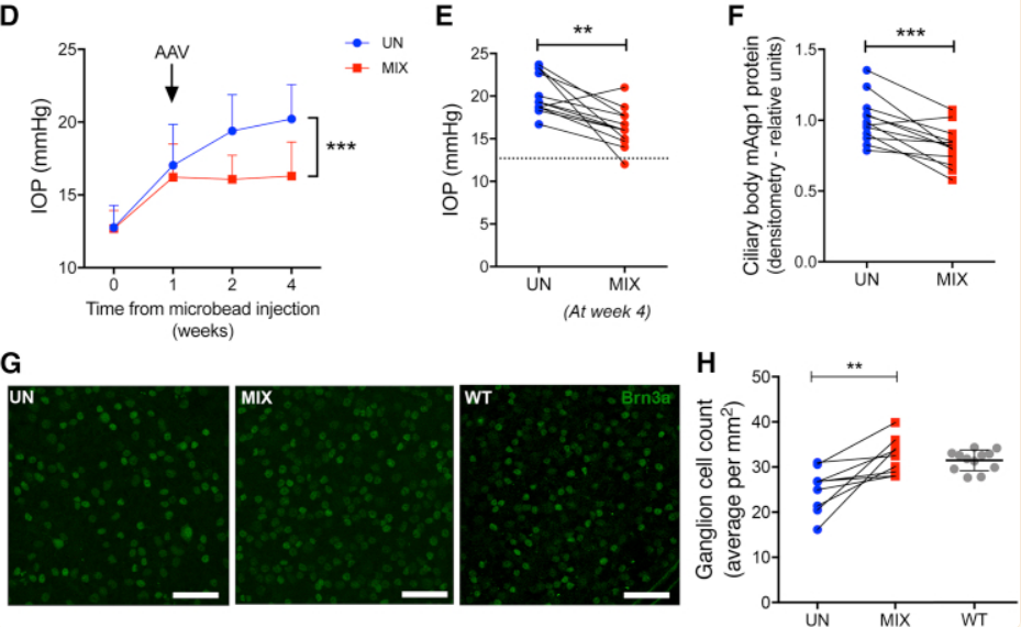 青光眼——造成不可逆伤害的隐形视力“杀手”