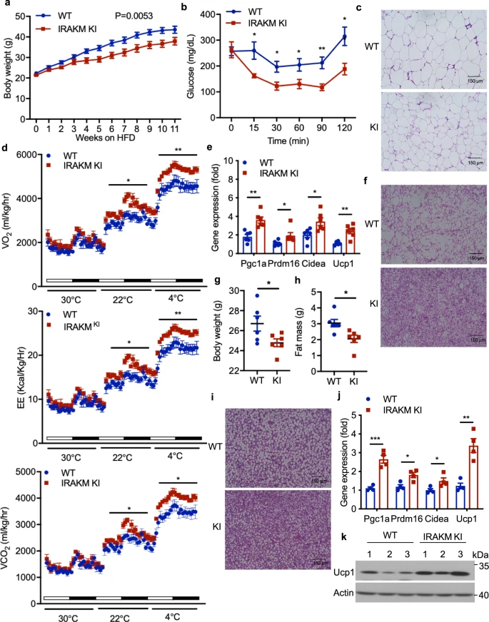 高脂饮食如何诱导肥胖