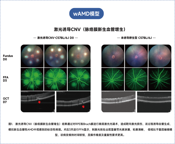 年龄相关性黄斑变性