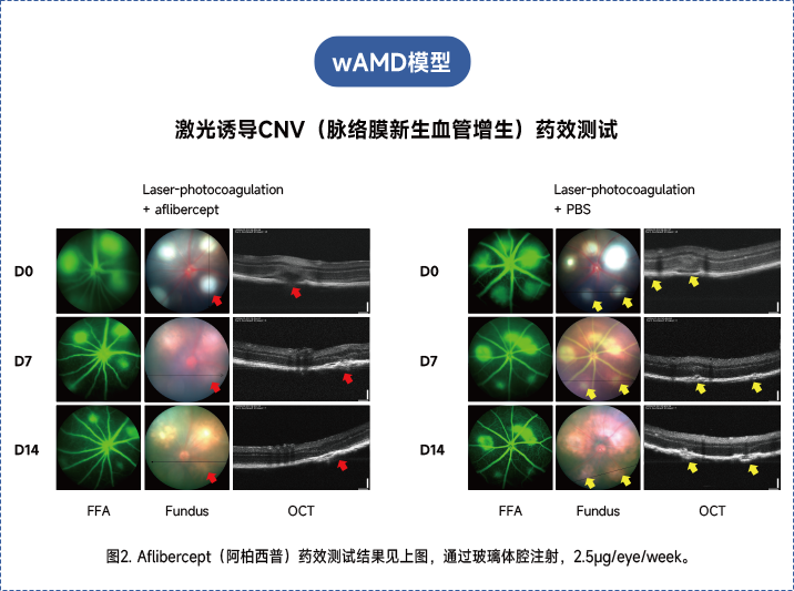 年龄相关性黄斑变性