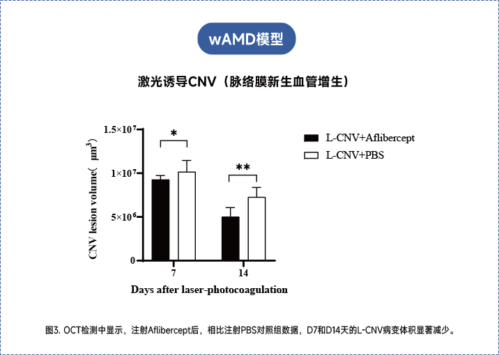 年龄相关性黄斑变性