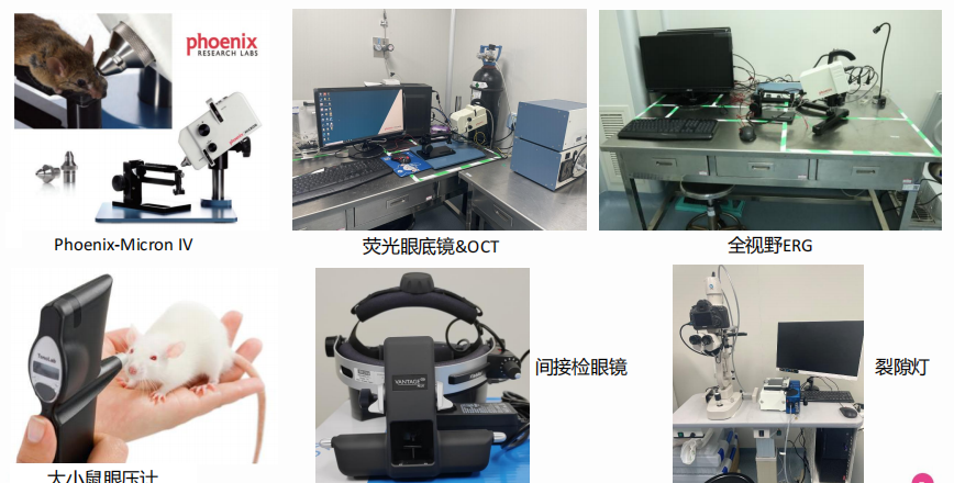 年龄相关性黄斑变性 年龄相关性黄斑变性