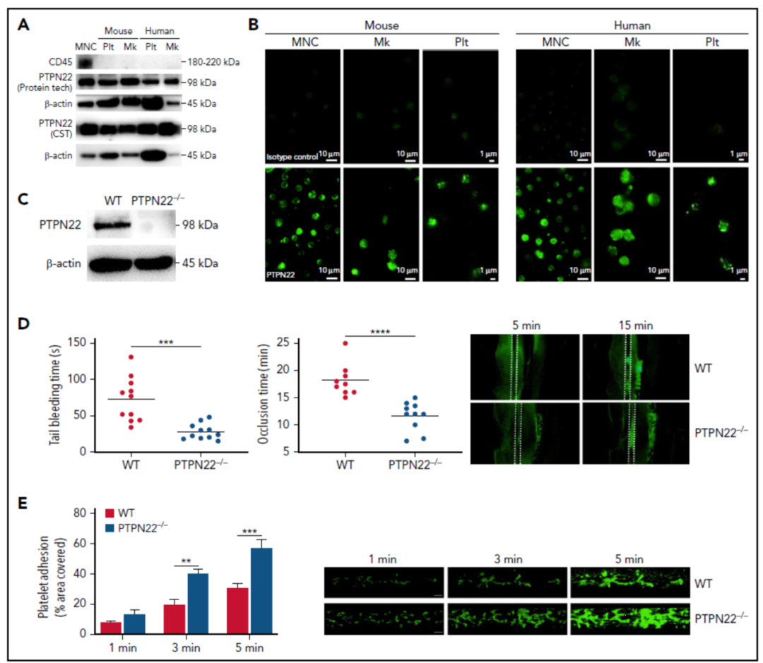 血小板功能和动脉血栓调控的新机制