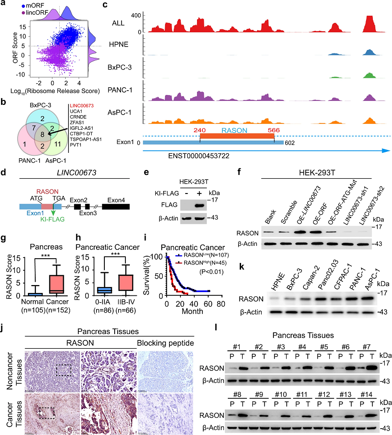 KRAS突变癌症的潜在治疗靶点