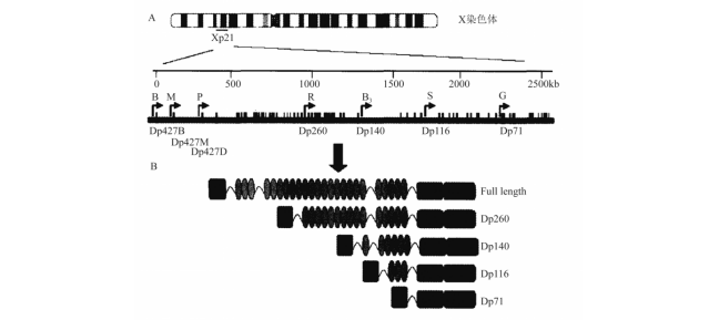 杜氏肌营养不良