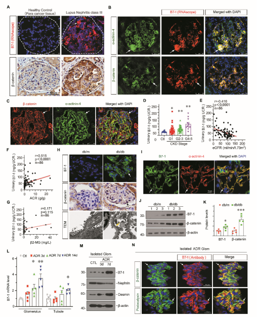 靶向B7-1的肾病疗法
