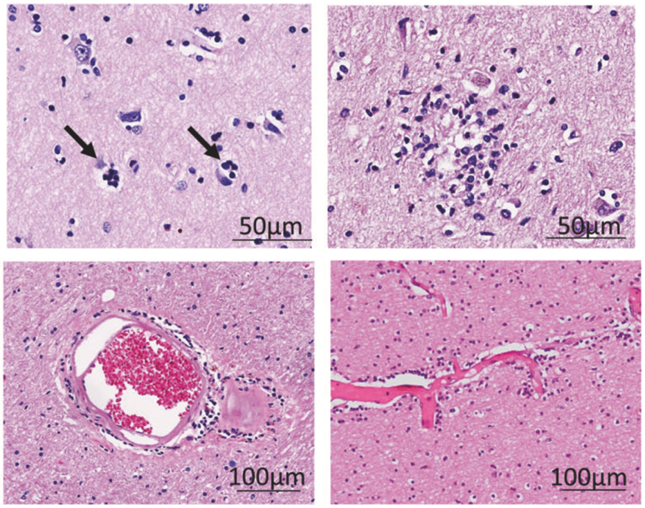 fc650e3040dd46b5a148fcafdd56a1ffjpg.png fc650e3040dd46b5a148fcafdd56a1ffjpg.png