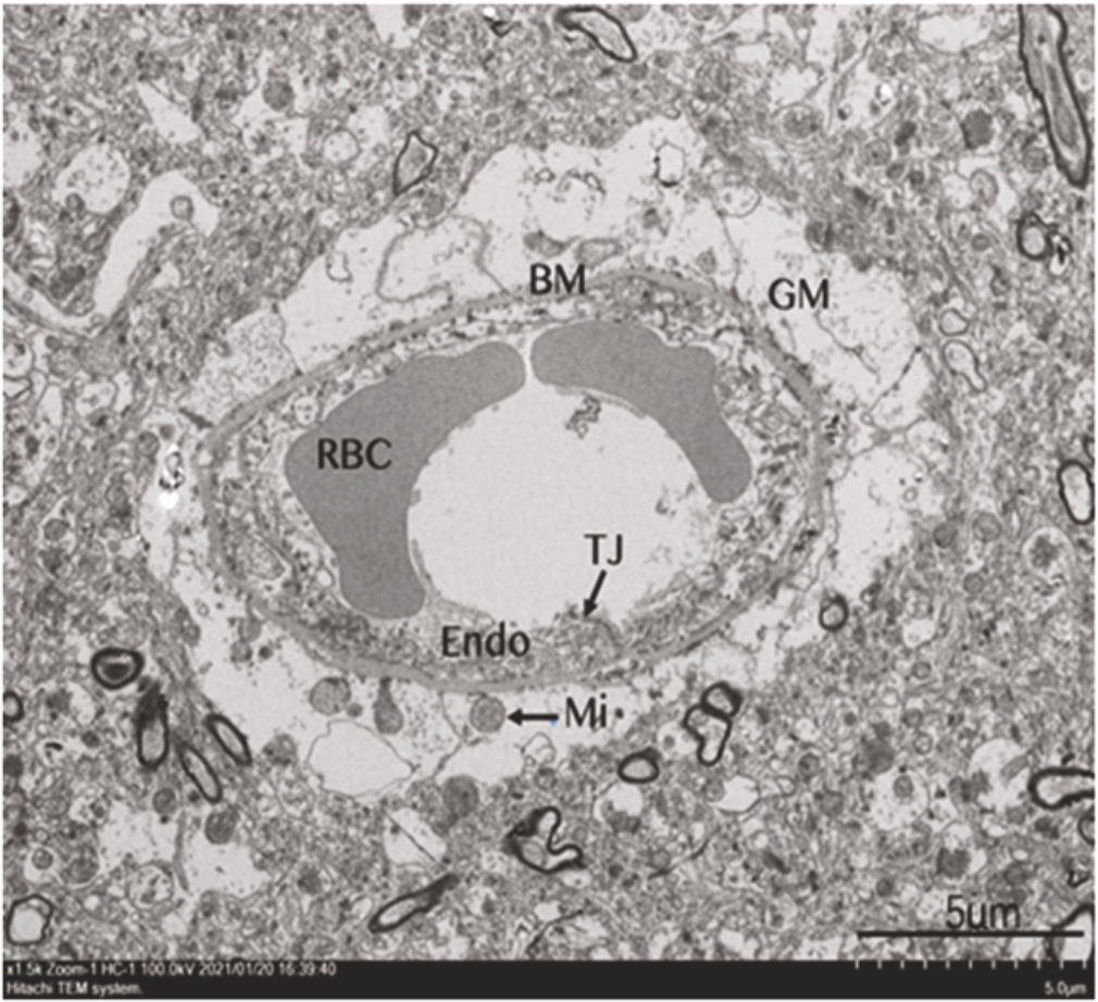 e08924a27f2745f1bb6fc67c008d4ac1jpg.png e08924a27f2745f1bb6fc67c008d4ac1jpg.png