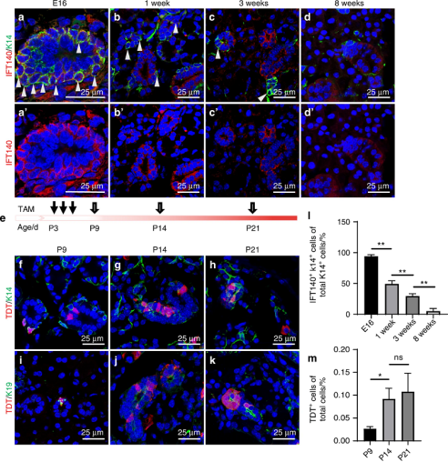 唾液腺干/祖细胞的标志物