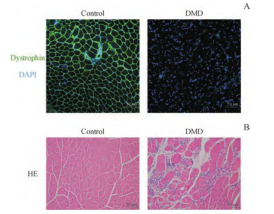 杜氏肌营养不良机理研究