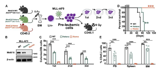 METTL16驱动白血病发生的机制