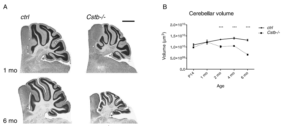 癫痫症小鼠模型