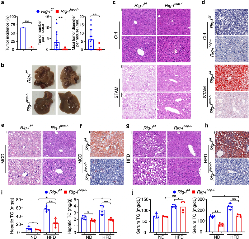 RIG-I在肝癌发生中的作用
