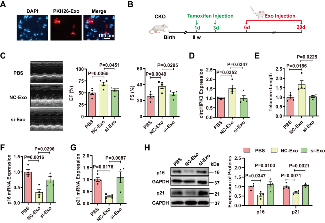 心肌再生修复新机制