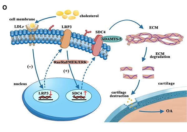 胆固醇代谢异常导致骨关节炎 胆固醇代谢异常导致骨关节炎