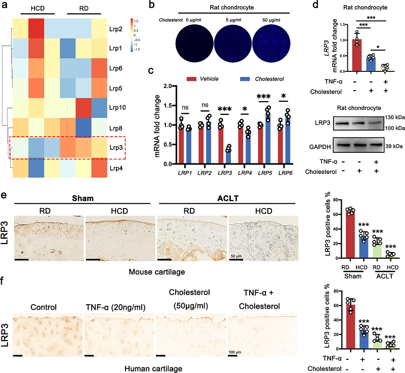 胆固醇代谢异常导致骨关节炎 胆固醇代谢异常导致骨关节炎