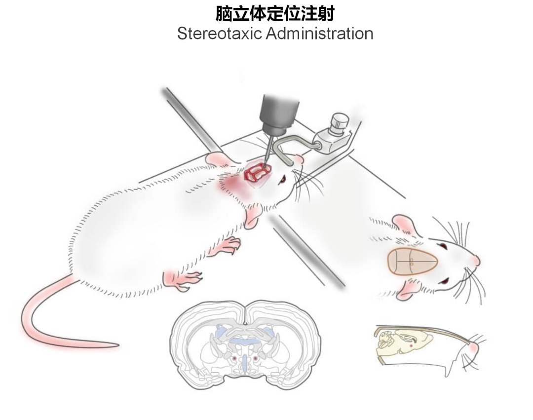 神经疾病CRO服务