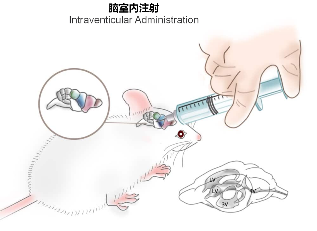 神经疾病CRO服务