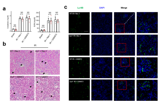 急性肾损伤发病机制