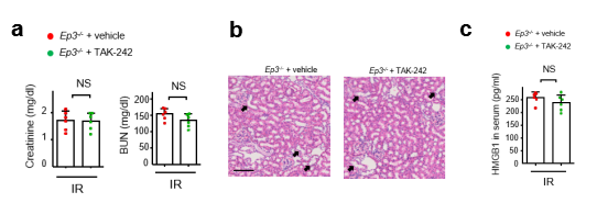 急性肾损伤发病机制