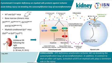 急性肾损伤发病机制
