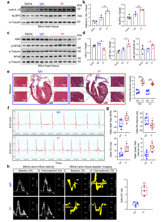 SARS-CoV-2诱发心功能障碍的机制