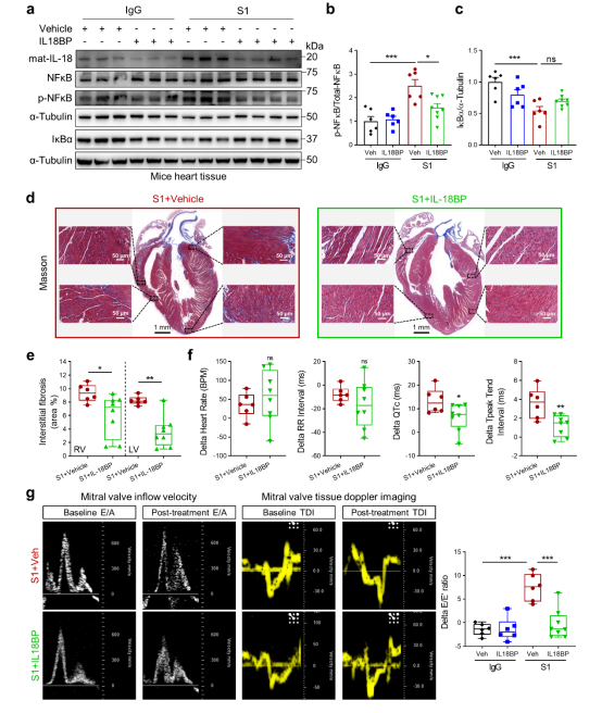 SARS-CoV-2诱发心功能障碍的机制