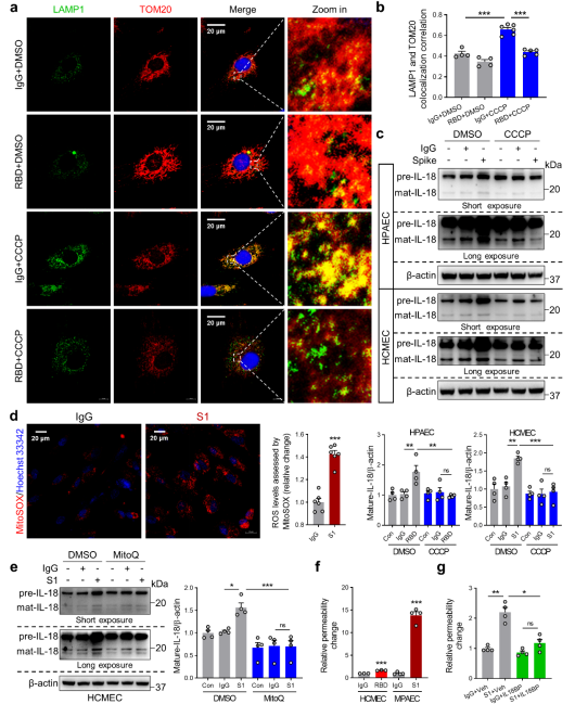 SARS-CoV-2诱发心功能障碍的机制