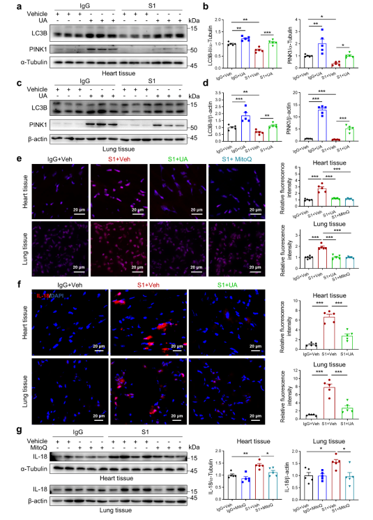 SARS-CoV-2诱发心功能障碍的机制