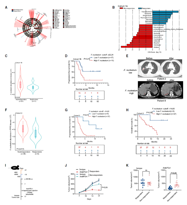 直肠癌免疫治疗抵抗