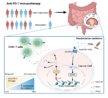 直肠癌免疫治疗抵抗