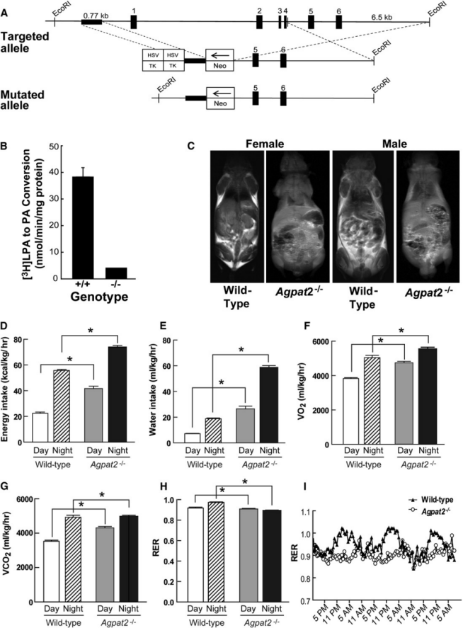 先天性全身性脂肪萎缩症 先天性全身性脂肪萎缩症