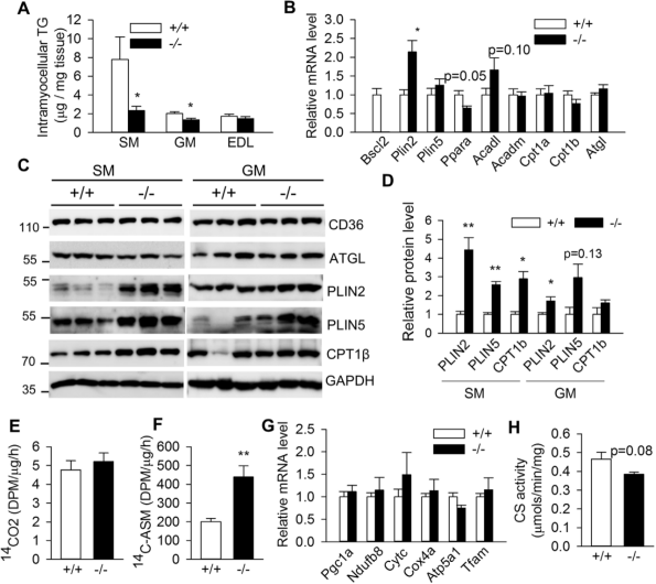 先天性全身性脂肪萎缩症