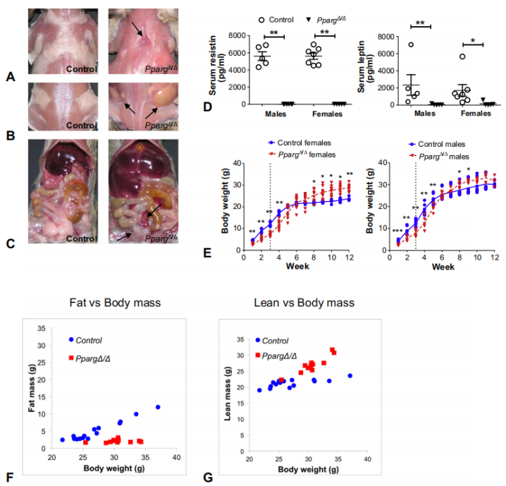 先天性全身性脂肪萎缩症 先天性全身性脂肪萎缩症