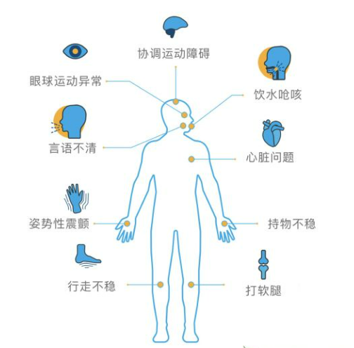 遗传性脊髓小脑共济失调