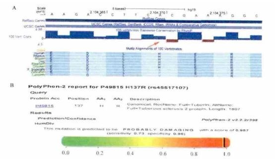 结节性硬化症 结节性硬化症