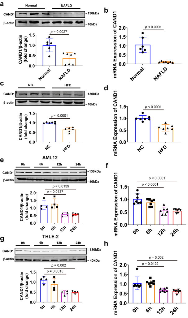 调控NAFLD疾病进程