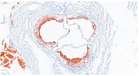 靶点Apoe和Ldlr基因