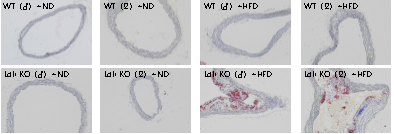 小鼠主动脉弓油红O染色