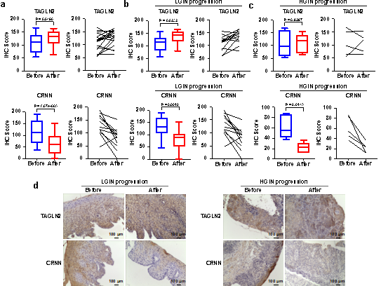 食管鳞状上皮癌前病变