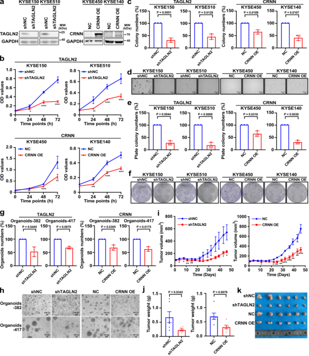 食管鳞状上皮癌前病变