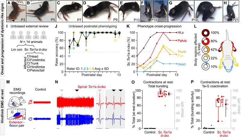 英国学者构建新模型来探索肌张力障碍的病理生理学