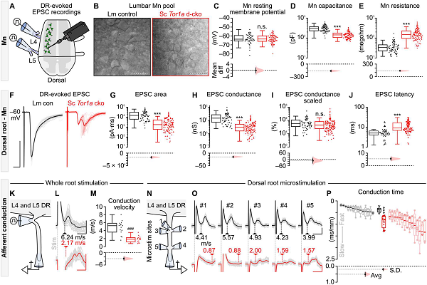 英国学者构建新模型来探索肌张力障碍的病理生理学