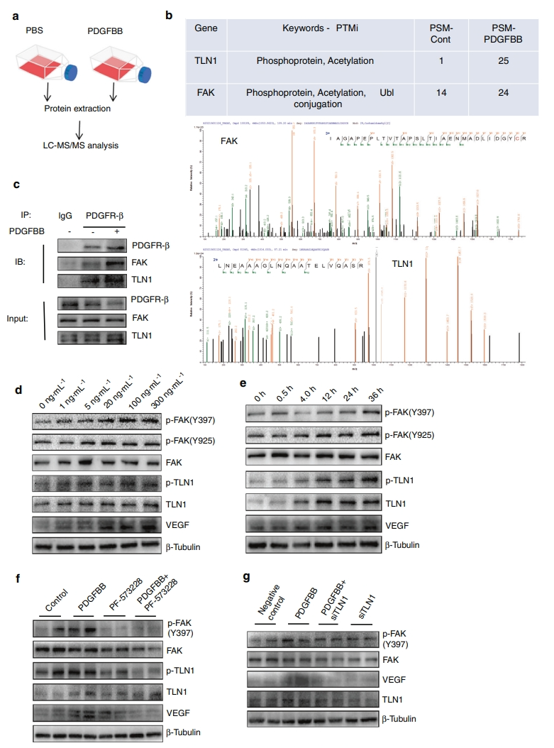 PDGFR-β通过增加依赖于H型血管的异常软骨下骨生成促进骨关节炎