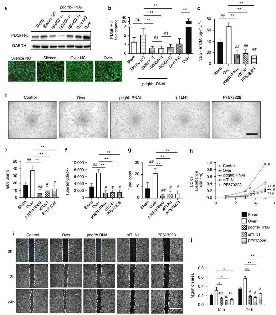 PDGFR-β通过增加依赖于H型血管的异常软骨下骨生成促进骨关节炎